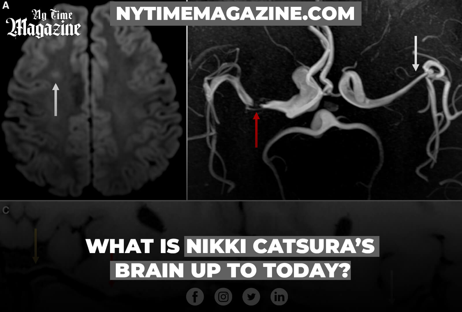 What Is Nikki Catsuras Brain Up To Today